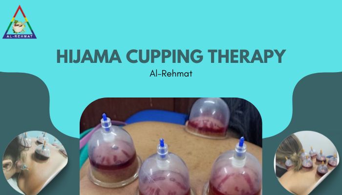 Hijama Cupping Therapy - Alrehmat